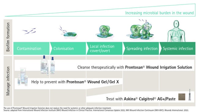 Adapted from: International Wound Infection Institute (IWII) Wound infection in clinical practice. Wounds International 2016